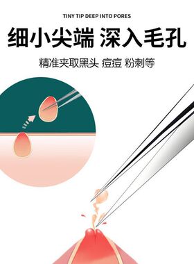 海豚夹子细胞夹去黑头镊子粉刺针套装高精密美容院专用超细尖头