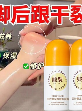 脚后跟干裂修复霜手足开裂皲裂治起皮润马油皱裂滚珠足跟滋润