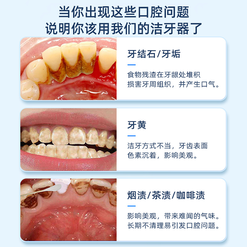 超声波电动牙刷冲牙器二合一家用洗牙器牙结石去除神器套装便携式 - 图0