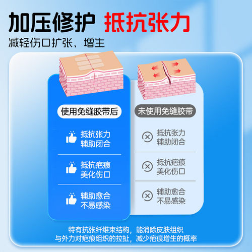 减张贴疤痕医用免缝胶带儿童皮肤拉合减张胶布术后伤口愈合减张器 - 图0