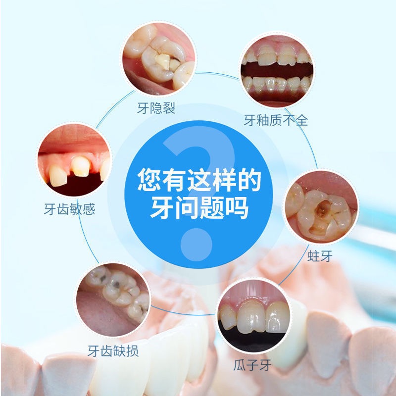 补牙神器自己补牙齿洞膏烂蛀假牙缝填充剂树脂材料临时缺牙烤瓷牙-图1