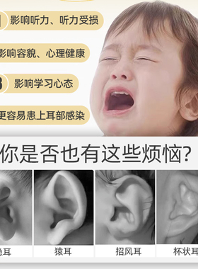 婴儿耳廓矫正器|超1000人收藏