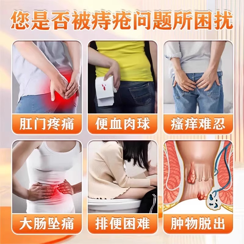 医用痔疮凝胶痔疮膏消肉球女性正品药内外混合痔排行榜第一名健康 - 图0