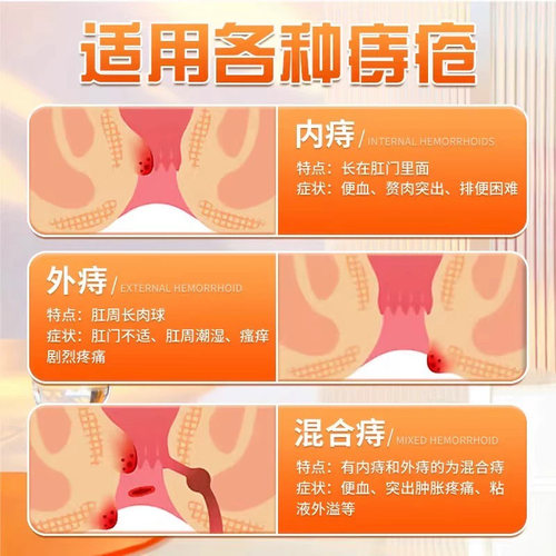 葵花医用痔疮凝胶敷料卡波姆肛裂瘙痒内外混合痔专用膏肉球bz国货 - 图1