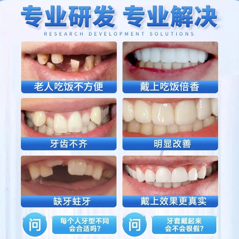 日本牙套吃饭神器老人没牙仿真贴片牙齿填充缺假牙缺牙自己在家补 - 图2