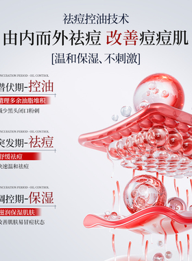 壬二酸凝胶软膏祛痘淡印去痘疤修复舒缓乳霜黑色素沉淀官方旗舰店