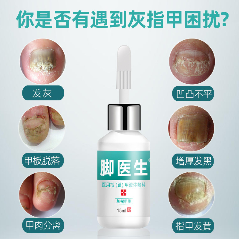 脚医生甲卫士灰指甲正品药冰醋酸 天天特卖工厂店保健理疗