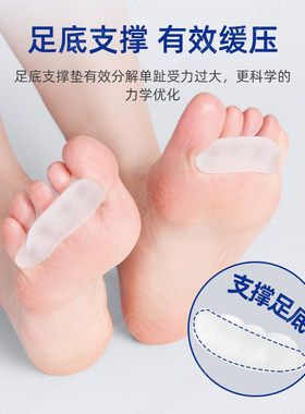 脚趾矫正器分趾器硅胶五趾重叠分离器拇指外翻纠正神器可穿鞋男女