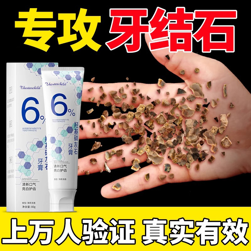 益生菌牙膏牙结石非速效去溶解洗白白黄牙口臭专用正品除烟渍羟基 - 图1