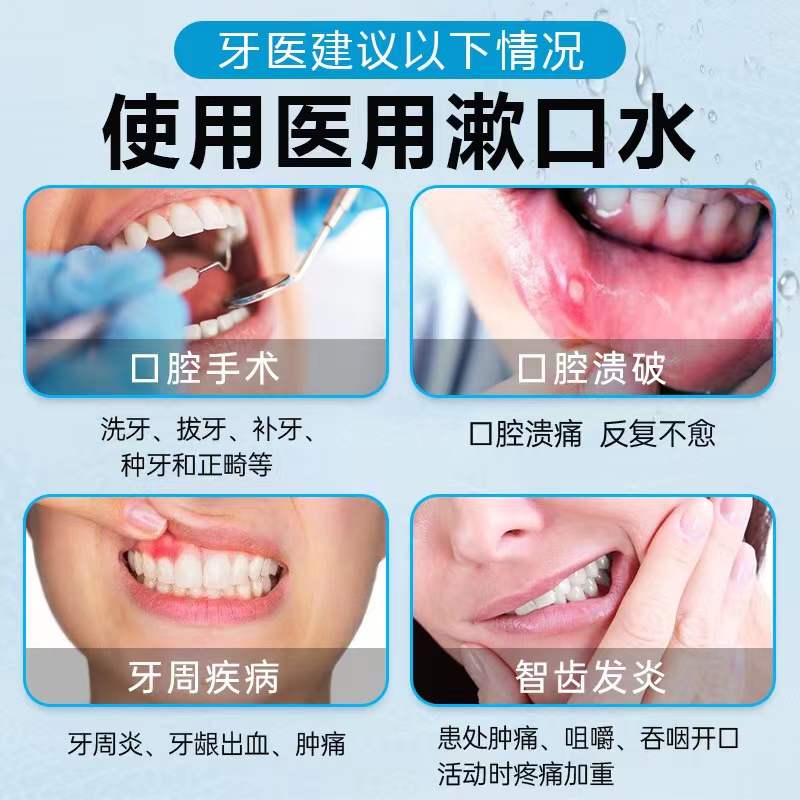 益生菌漱口水杀菌口臭抗菌牙结石 天天特卖工厂店漱口水