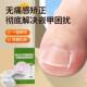Ingrown toenail correction pad | Over 6,000 additional purchases