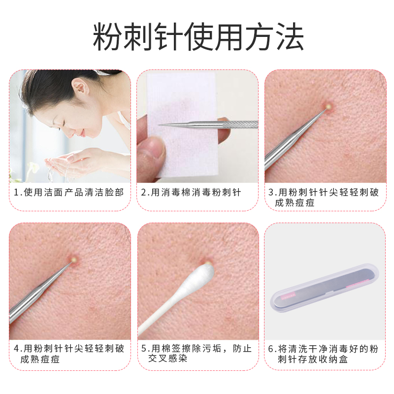 天天特卖工厂店粉刺夹去黑头夹镊子美容院专用刮闭口粉刺黑头痘痘针工具套装2