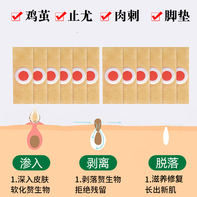 南京同仁堂鸡眼贴鸡眼膏药去脚底疣灵跖疣肉刺瘊子鸡尤净康茧角质 - 图2