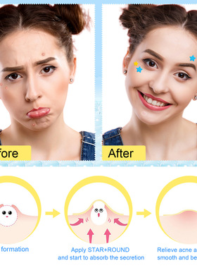 ELAIMEI 新款彩色爱心星星茶树痘痘贴水胶体ACNE PATCHES