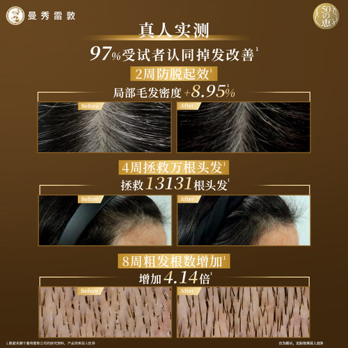 【曼秀雷敦】50惠育发精华养润防脱精华液防掉发滋养固发头皮护理 - 图2