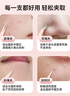 纳葆蓓粉丝印记粉刺夹送收纳盒高咬合无缝隙无错位粉刺黑头痘痘