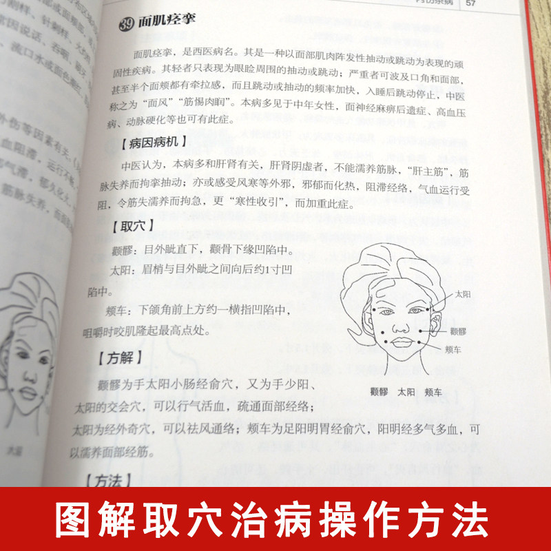 正版中医传统疗法治百病系列刺血治百病刺血疗法教程刺络法中医养生保健中医拔罐放血治病针炙学民间刺血术书籍常见病治疗书_虎窝淘