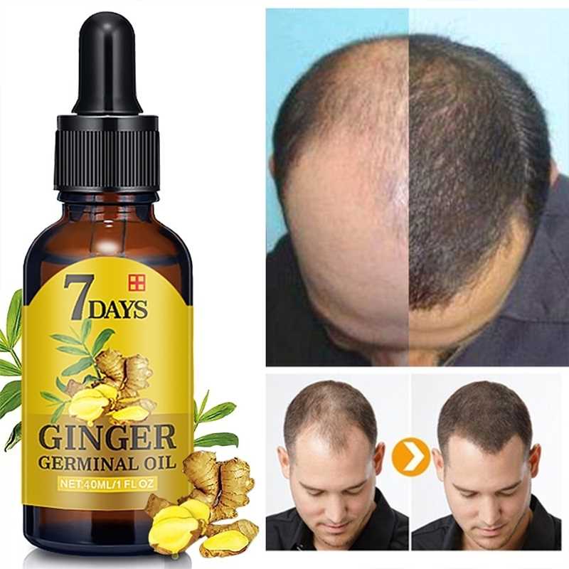 7 day Ginger Hair Growth Nutrient Solution Hair Loss Treatme - 图0