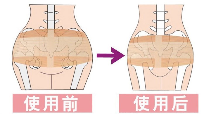 医疗骨盆固定带 盆骨矫正带  产后束臀 带钢板 孕妇合盆带