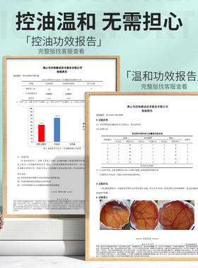 【加强版】艾侬·蔚蓝：酵母锌细肤清透控油乳