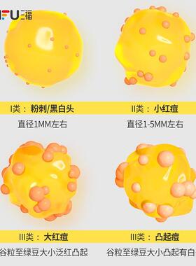 闪购羽素胶态硫祛痘精华液5ml 面部清洁用品祛痘膏 474050