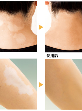 日本SCJapan白色斑专用粉底液