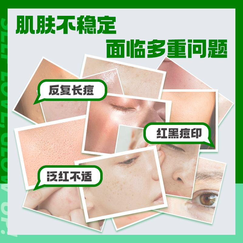 MZ迷之7天booster神经酰胺精华液改善瑕疵熊果苷改善保湿