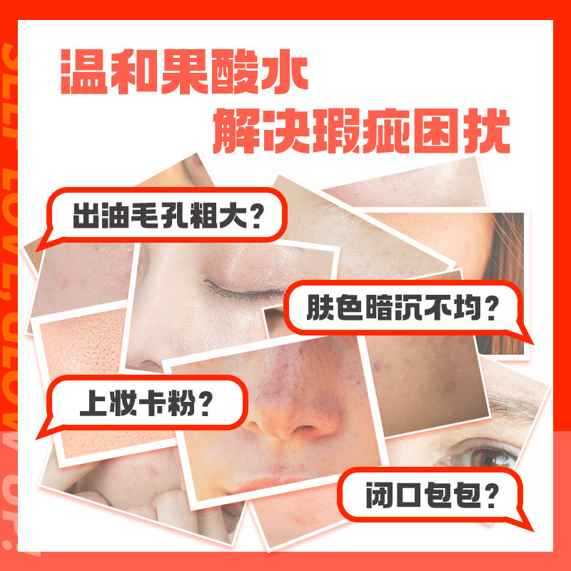 mz迷之果酸水闭口粉刺黑头爽肤水 迷之化妆水/爽肤水