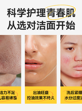 郁美净青少年控油洁颜露净澈洁面乳洗面奶细毛孔黑头13岁以上