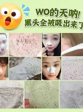 【官方正品】泰国芦荟胶去黑头膏粉刺鼻贴撕拉式收缩毛孔鼻腔清洁