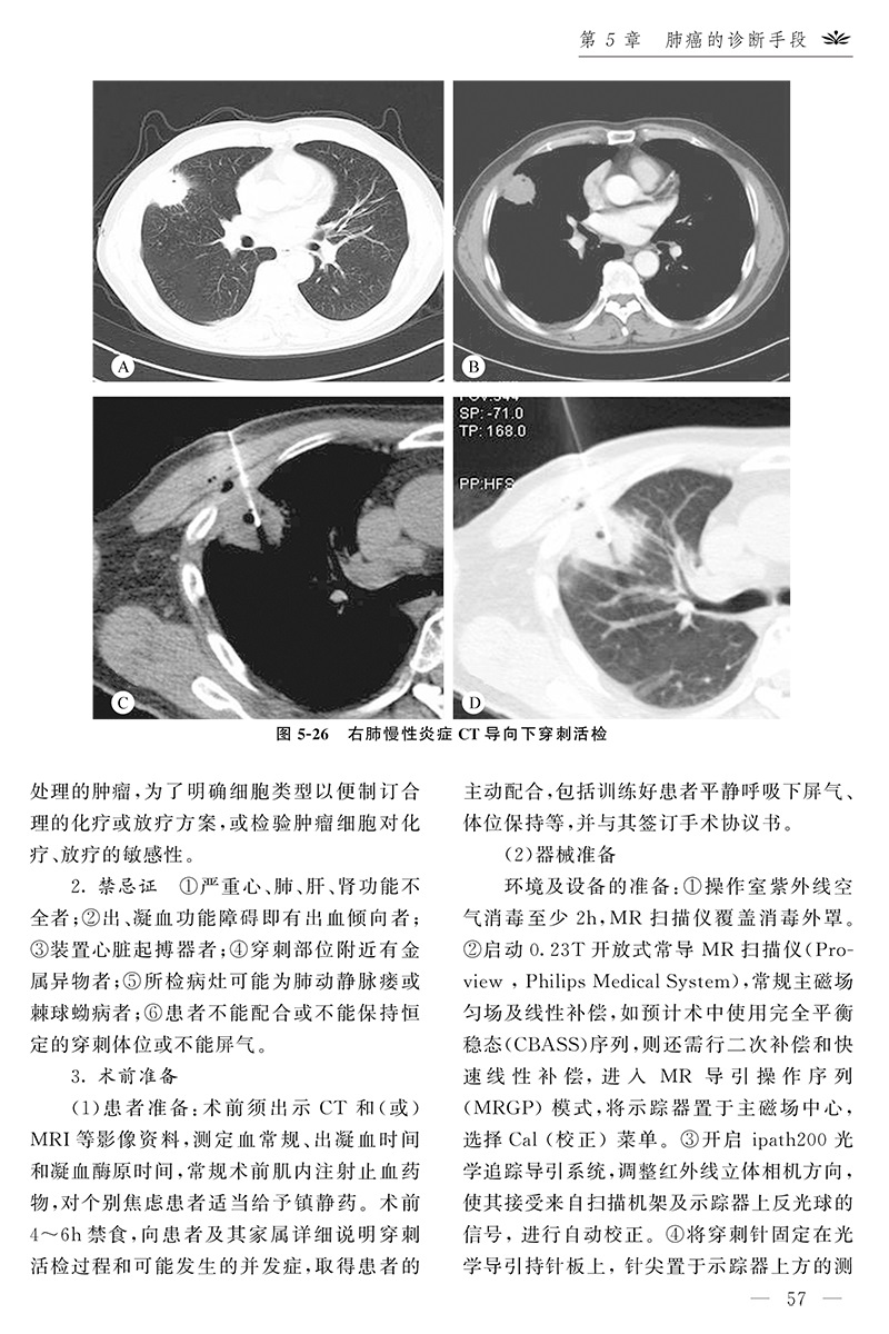 现货正版肺癌诊断与治疗第2版王强修李钧朱良明河南科学技术出版社9787534990472-图1