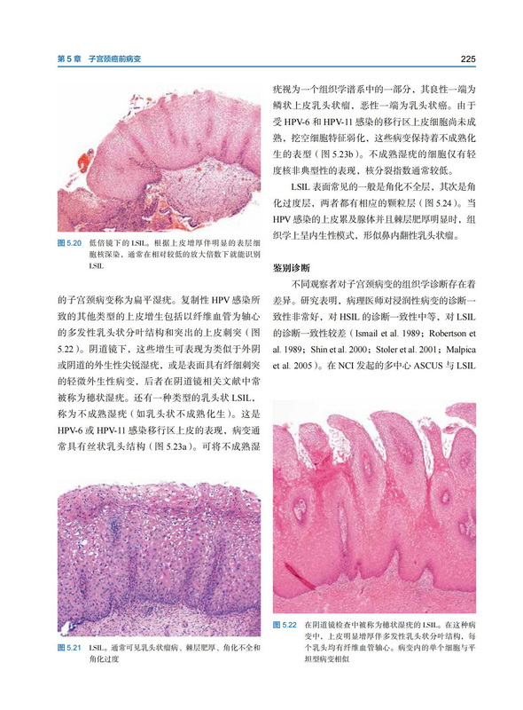 现货速发  Blaustein女性生殖道病理学第7版 薛德彬 译 北京科学技术出版社 9787571425012 - 图2