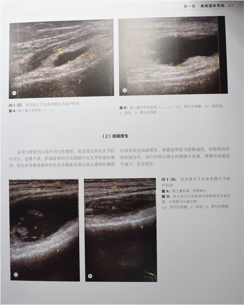 正版现货图解风湿病学蒋明主编中国协和医科大学出版社-图2