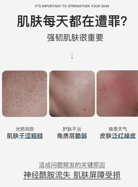 SOR索尔神经酰胺精华液淡化痘印修复肌肤保质期到