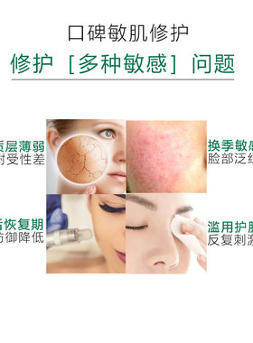 脸部过敏感肌肤护肤品皮肤止痒膏