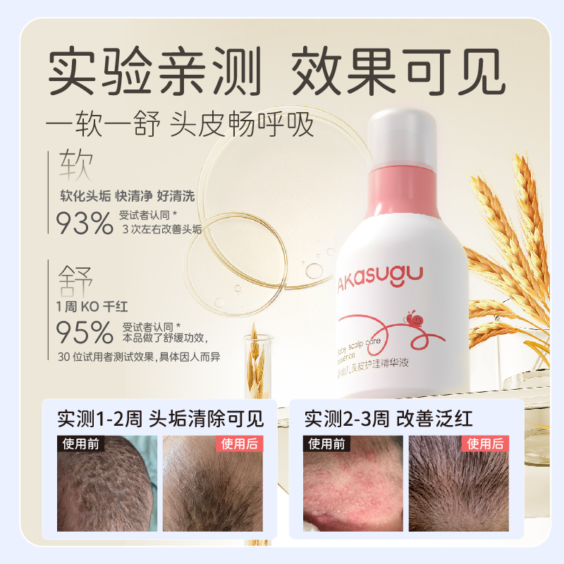 Akasugu爱舒屋婴幼儿去头垢新生儿去除奶痂头皮护理精华液小样