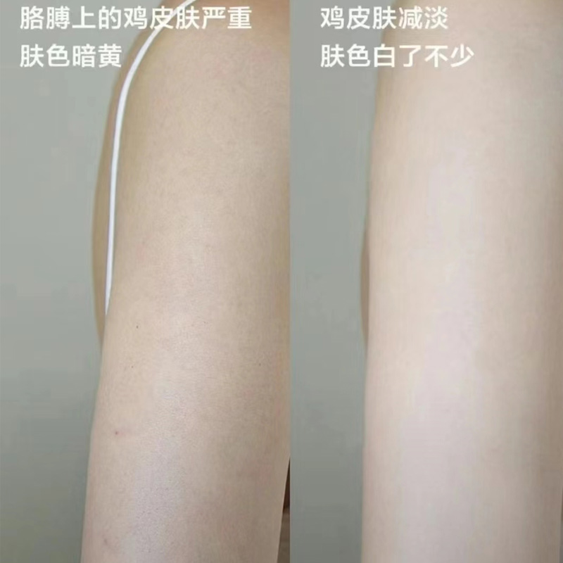 保税 sesderma身体乳滋润保湿烟酰胺提亮200ml效期25.1月/4月-图2