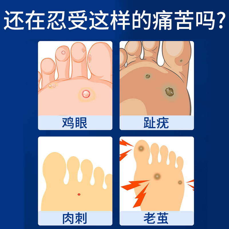 白云山鸡眼贴药膏跖疣脚鸡眼肉刺贴鸡眼帖手脚底上鸡疣祛除去gb - 图0