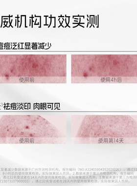 喜辽妥20%壬二酸精华霜