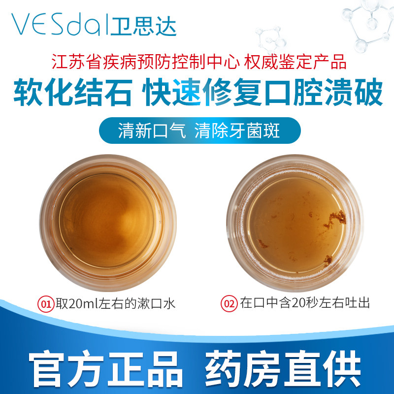 卫思达除口臭去牙渍口气清新漱口水 卫思达漱口水
