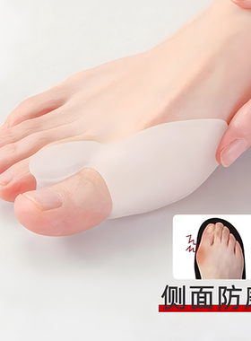 脚趾内外翻矫正器大拇指