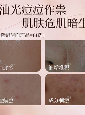夫专家控油洁面乳深层清洁洗面奶