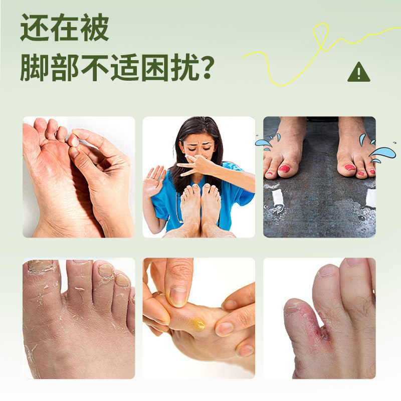 夫专家金三角15g抑菌软膏植物配方清洁抑菌肤专家官方旗舰店,淘宝优惠券,粉丝福利购,淘宝优惠卷