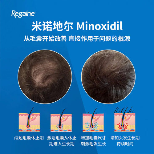 德国Regaine培健落建米诺地尔男士泡沫剂防脱育发液3x60g - 图2