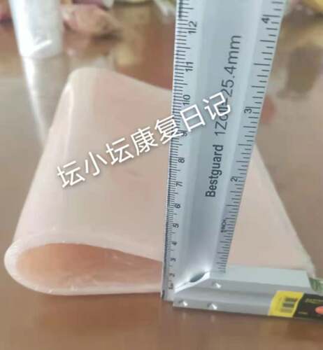 硅胶垫疤痕压力垫平复增生抗疤痕贴弹力绷带术后关节烫伤加压软垫 - 图3
