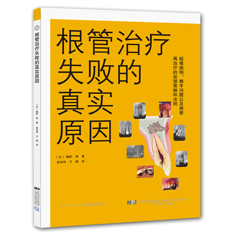 共2本现代根管外科理论与实践/根管治疗失败的真实原因日鶴町保著口腔修复正畸种植学医学类专业书籍图谱牙体牙髓病真正根尖周病变 - 图0