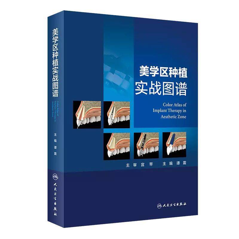 套装共3本美学区种植从设计理念到临床实战配增值/美学区种植实战图谱/美学区种植成功之道刘峰宿玉成汤春波等口腔种植学美学分析