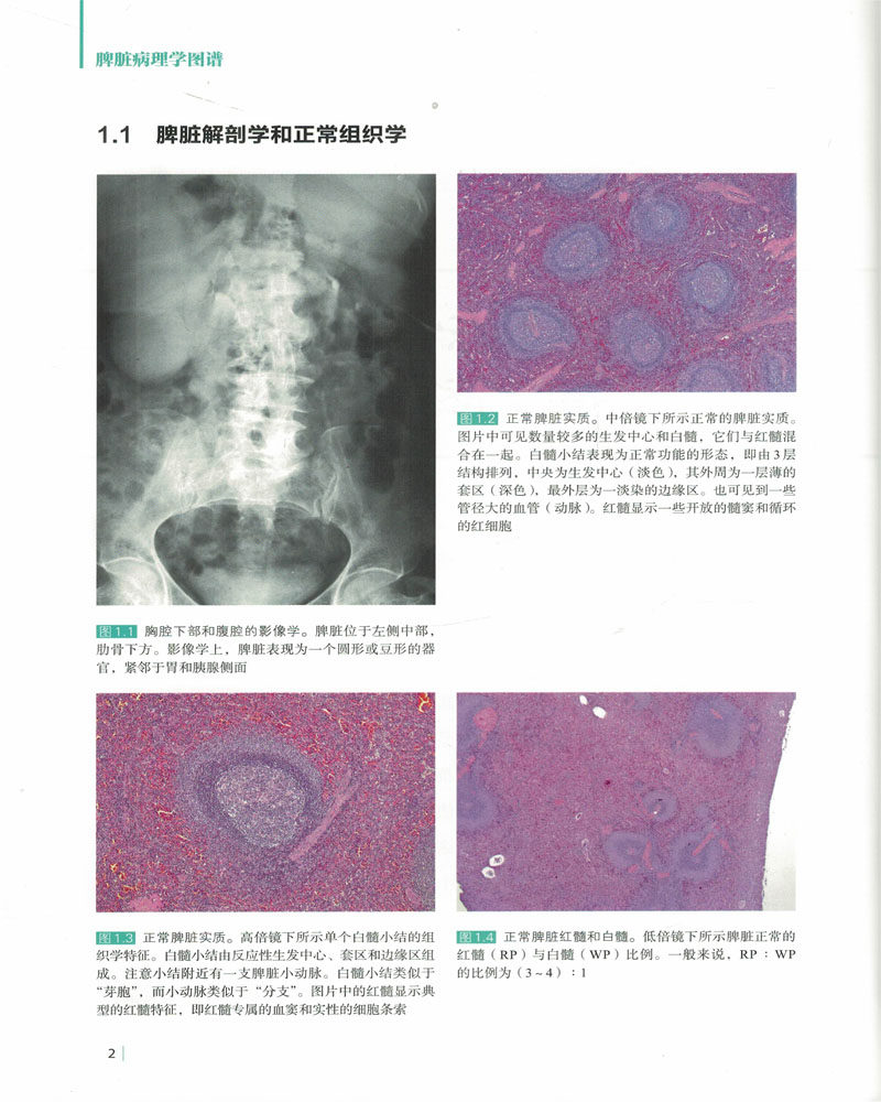 现货(美)丹尼斯北京脾脏病理学图谱 希尔麦图书医学图谱