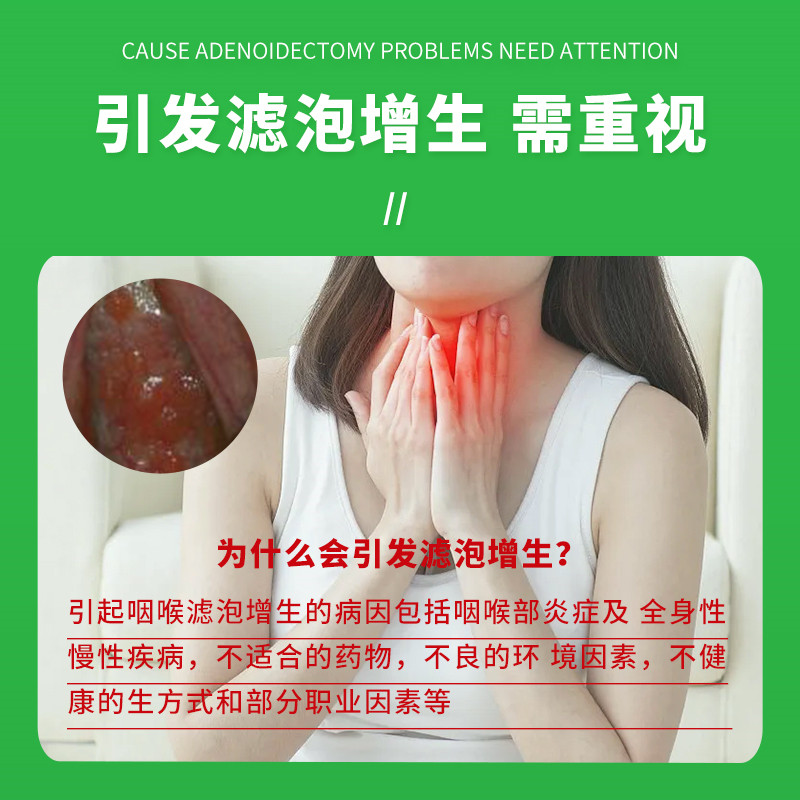 咽喉喉咙嗓子舌头根咽后壁淋巴滤泡增生滤泡性咽炎云南本草喷雾剂 - 图0