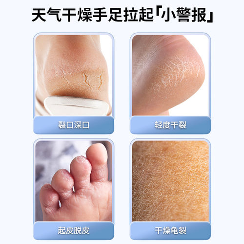 DoryThos比诗足部皴裂凝露手脚足干裂防冻裂保湿滋润皲裂膏秋冬季-图0